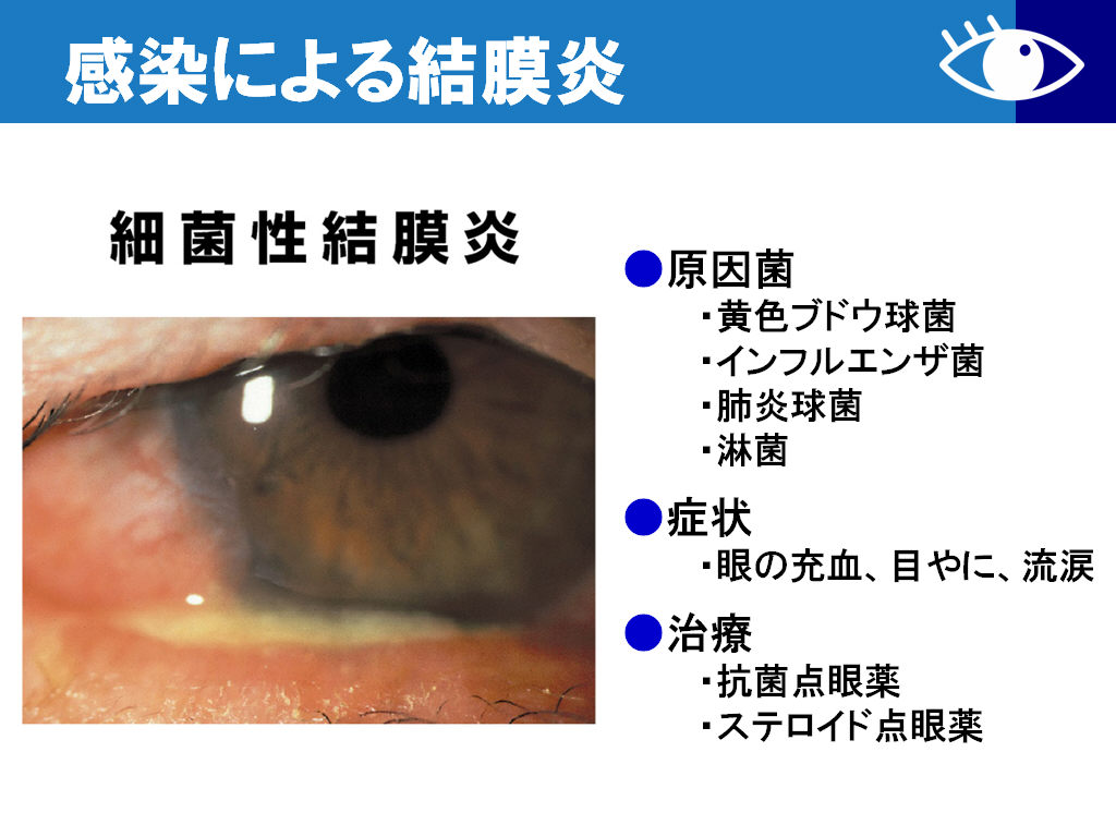 方 結膜炎 治し